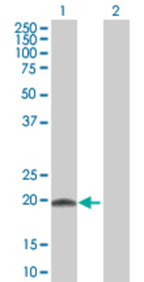 Lane 1: RGS10 transfected lysate (20.02 KDa) Lane 2: Non-transfected lysate.