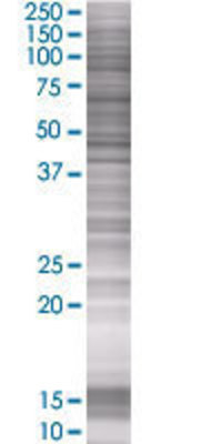 ASAHL transfected lysate.