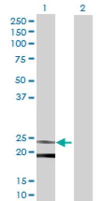 Lane 1: ASAHL transfected lysate (22 KDa) Lane 2: Non-transfected lysate.