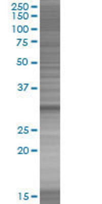 CDCA8 transfected lysate.