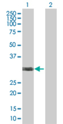 Lane 1: CDCA8 transfected lysate (31.3 KDa) Lane 2: Non-transfected lysate.