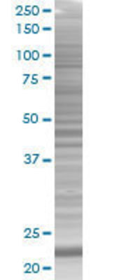 PYCARD transfected lysate.