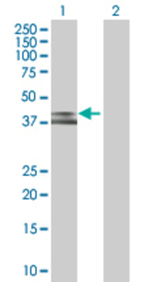 Lane 1: CCRL2 transfected lysate (39.5 KDa) Lane 2: Non-transfected lysate.
