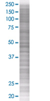 CCRL2 transfected lysate.