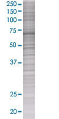PCK1 transfected lysate.