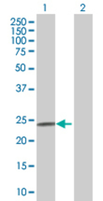 Lane 1: FNDC4 transfected lysate (25.85 KDa) Lane 2: Non-transfected lysate.