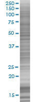 SLC25A5 transfected lysate.