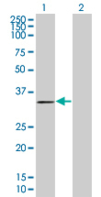 Lane 1: SLC25A5 transfected lysate (32.89 KDa) Lane 2: Non-transfected lysate.