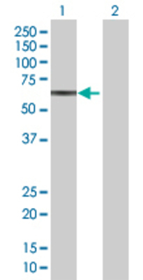 Lane 1: HEXB transfected lysate (63.1 KDa) Lane 2: Non-transfected lysate.