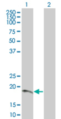 Lane 1: CDKN2D transfected lysate (17.7 KDa). Lane 2: Non-transfected lysate.
