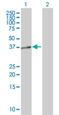 Lane 1: LIN28 transfected lysate (23.1 KDa). Lane 2: Non-transfected lysate.