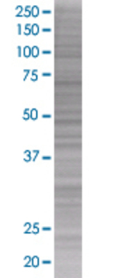 RAD51L1 transfected lysate