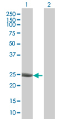 Lane 1: TPD52L1 transfected lysate (22.4 KDa) Lane 2: Non-transfected lysate.