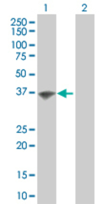 Lane 1: HSH2D transfected lysate (39 KDa). Lane 2: Non-transfected lysate.