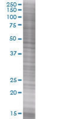 HSH2D transfected lysate
