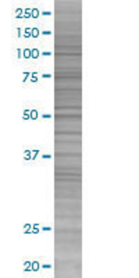 PIM2 transfected lysate.