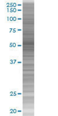 GPI transfected lysate.
