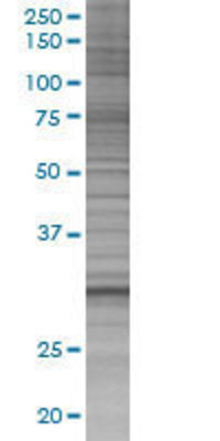 ECHS1 transfected lysate.