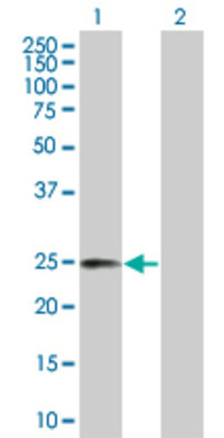 Lane 1: TNFRSF18 transfected lysate (26 KDa) Lane 2: Non-transfected lysate.