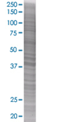 HSH2D transfected lysate