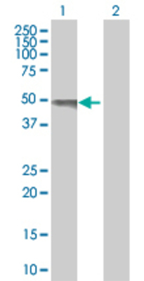 Lane 1: HSH2D transfected lysate (38.83 KDa). Lane 2: Non-transfected lysate.