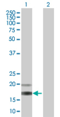 Lane 1: SIRPB1 transfected lysate (19.4 KDa). Lane 2: Non-transfected lysate.