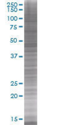 HDAC3 transfected lysate