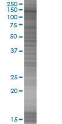 CHERP transfected lysate.