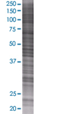 SERPINB3 transfected lysate.