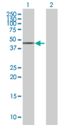 Lane 1: SERPINB3 transfected lysate (43.01 KDa) Lane 2: Non-transfected lysate.