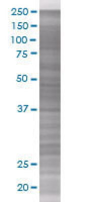 NAP1L1 transfected lysate.