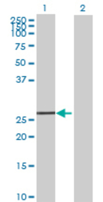 Lane 1: EXOSC5 transfected lysate (25.96 KDa) Lane 2: Non-transfected lysate.