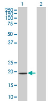 Lane 1: NQO2 transfected lysate (26 KDa) Lane 2: Non-transfected lysate.