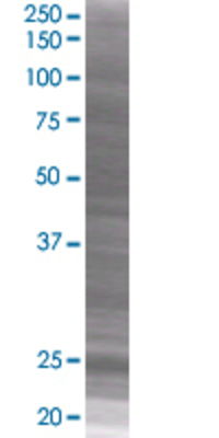 NQO2 transfected lysate.