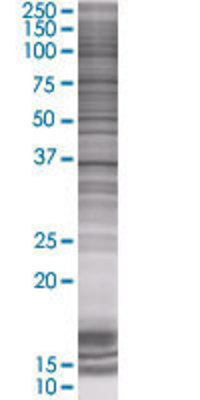 CRYZ transfected lysate.