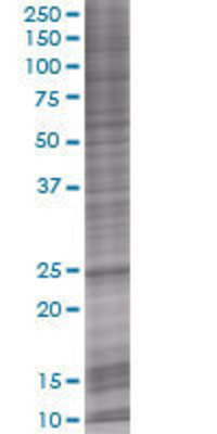 ANAPC10 transfected lysate