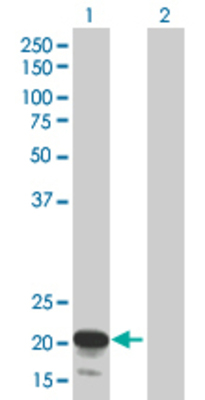 Lane 1: ANAPC10 transfected lysate (20.46 KDa). Lane 2: Non-transfected lysate.
