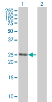 Lane 1: PSMD8 transfected lysate (30 KDa). Lane 2: Non-transfected lysate.