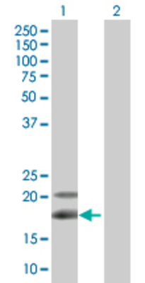 Lane 1: NTS transfected lysate (19.8 KDa). Lane 2: Non-transfected lysate.