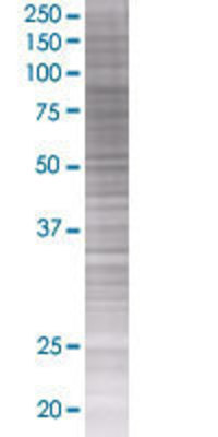 MX1 transfected lysate.