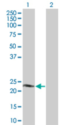 Lane 1: TEB1 transfected lysate (24.86 KDa) Lane 2: Non-transfected lysate.