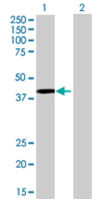 Lane 1: GYG1 transfected lysate (36.74 KDa) Lane 2: Non-transfected lysate.