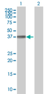 Lane 1: AREG transfected lysate (27.83 KDa) Lane 2: Non-transfected lysate.