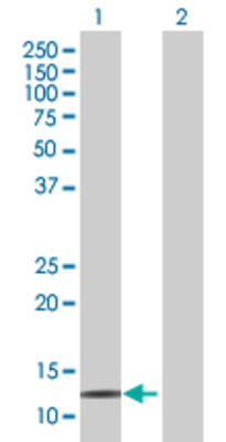 Lane 1: HOP transfected lysate (8.14 KDa) Lane 2: Non-transfected lysate.
