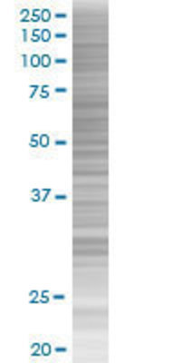 HOP transfected lysate.