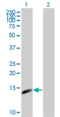 Lane 1: CDKN2C transfected lysate (18.1 KDa) Lane 2: Non-transfected lysate.