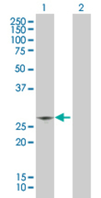 Lane 1: CIDEC transfected lysate (26.8 KDa). Lane 2: Non-transfected lysate.
