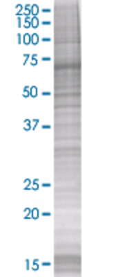 CIDEC transfected lysate