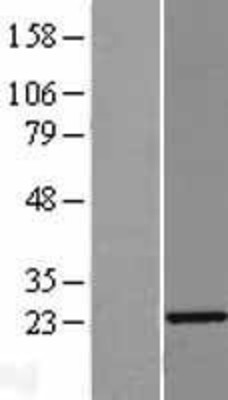 Western Blot: RAP1A Overexpression Lysate (Adult Normal) [NBL1-15146] Left-Empty vector transfected control cell lysate (HEK293 cell lysate); Right -Over-expression Lysate for RAP1A.