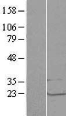 Western Blot: LSM1 Overexpression Lysate (Adult Normal) [NBL1-12720] Left-Empty vector transfected control cell lysate (HEK293 cell lysate); Right -Over-expression Lysate for LSM1.